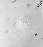 Myxozoans such as Myxobolus cerebralis are single-celled parasites, never more than 20 μm across.